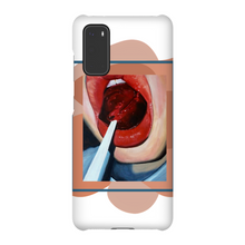 Load image into Gallery viewer, "Pop"Case for Smart Phones