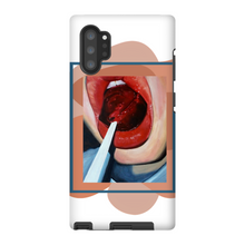 Load image into Gallery viewer, "Pop"Case for Smart Phones