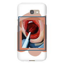 Load image into Gallery viewer, "Pop"Case for Smart Phones