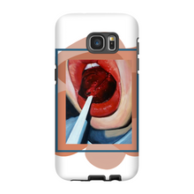 Load image into Gallery viewer, "Pop"Case for Smart Phones