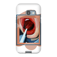 Load image into Gallery viewer, "Pop"Case for Smart Phones