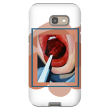 Load image into Gallery viewer, "Pop"Case for Smart Phones