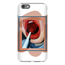Load image into Gallery viewer, "Pop"Case for Smart Phones