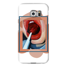 Load image into Gallery viewer, "Pop"Case for Smart Phones