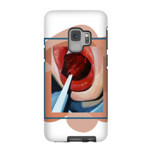 Load image into Gallery viewer, "Pop"Case for Smart Phones