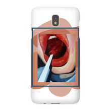 Load image into Gallery viewer, "Pop"Case for Smart Phones