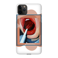 Load image into Gallery viewer, "Pop"Case for Smart Phones