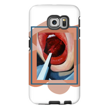 Load image into Gallery viewer, "Pop"Case for Smart Phones