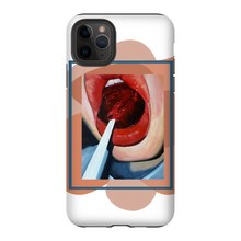 Load image into Gallery viewer, "Pop"Case for Smart Phones