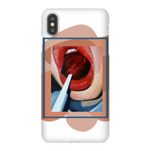 Load image into Gallery viewer, "Pop"Case for Smart Phones