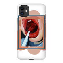 Load image into Gallery viewer, &quot;Pop&quot;Case for Smart Phones

