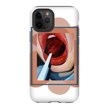 Load image into Gallery viewer, &quot;Pop&quot;Case for Smart Phones
