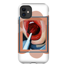 Load image into Gallery viewer, &quot;Pop&quot;Case for Smart Phones
