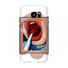 Load image into Gallery viewer, &quot;Pop&quot;Case for Smart Phones
